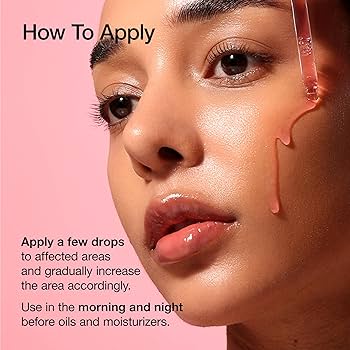 Amazon.com: ANUA Niacinamide 10 + TXA 4 Serum, Hyaluronic